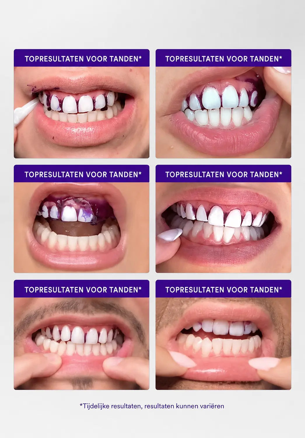 WITTSMILE™ — Direct wittere tanden | Koop 1, krijg 1 gratis