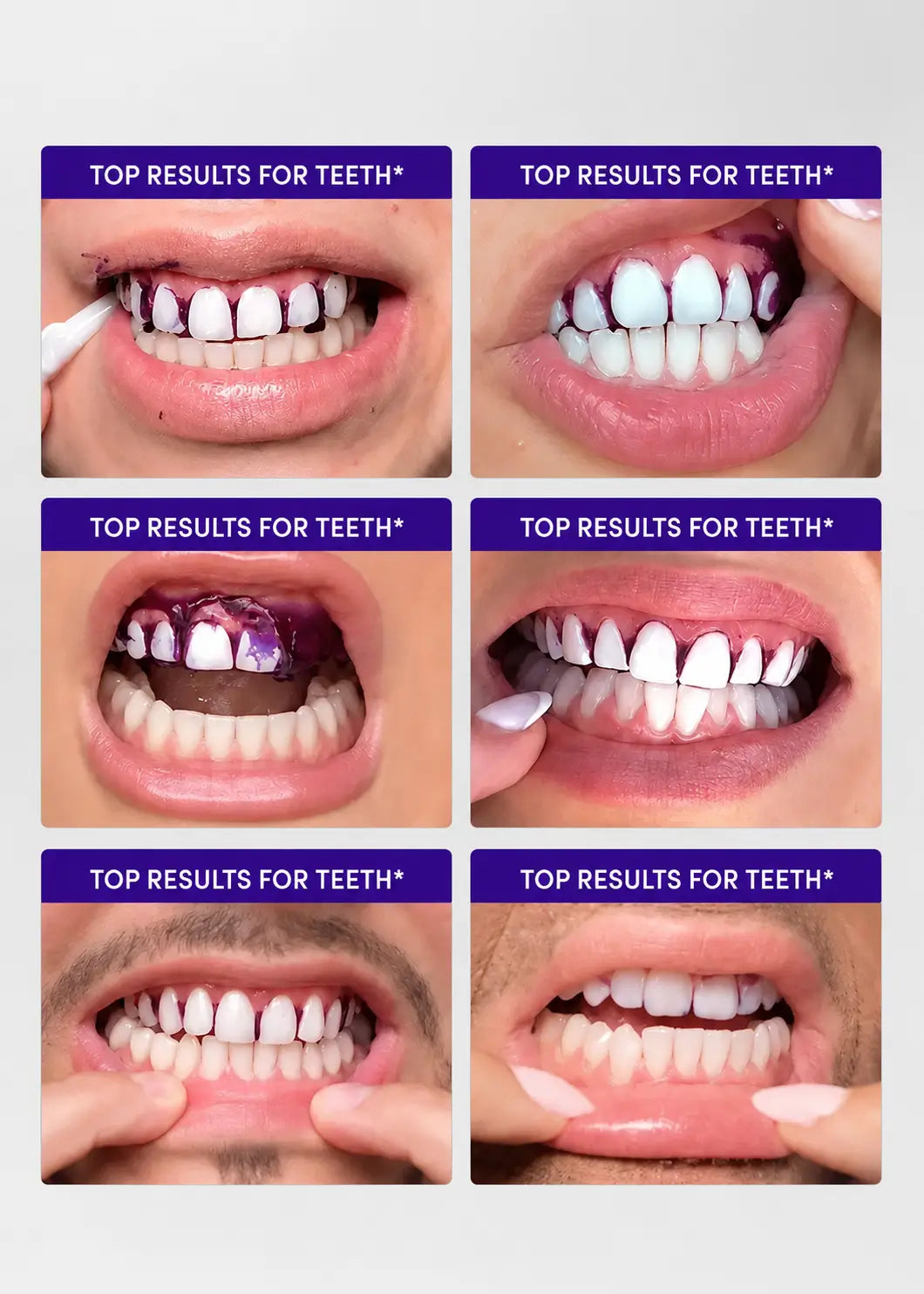 WittSmile™ — Instantly Whiter Teeth | Buy 7, Get 14 Free