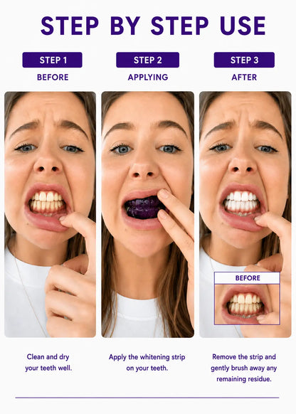 WittSmile™ — Instantly Whiter Teeth | Buy 7, Get 14 Free