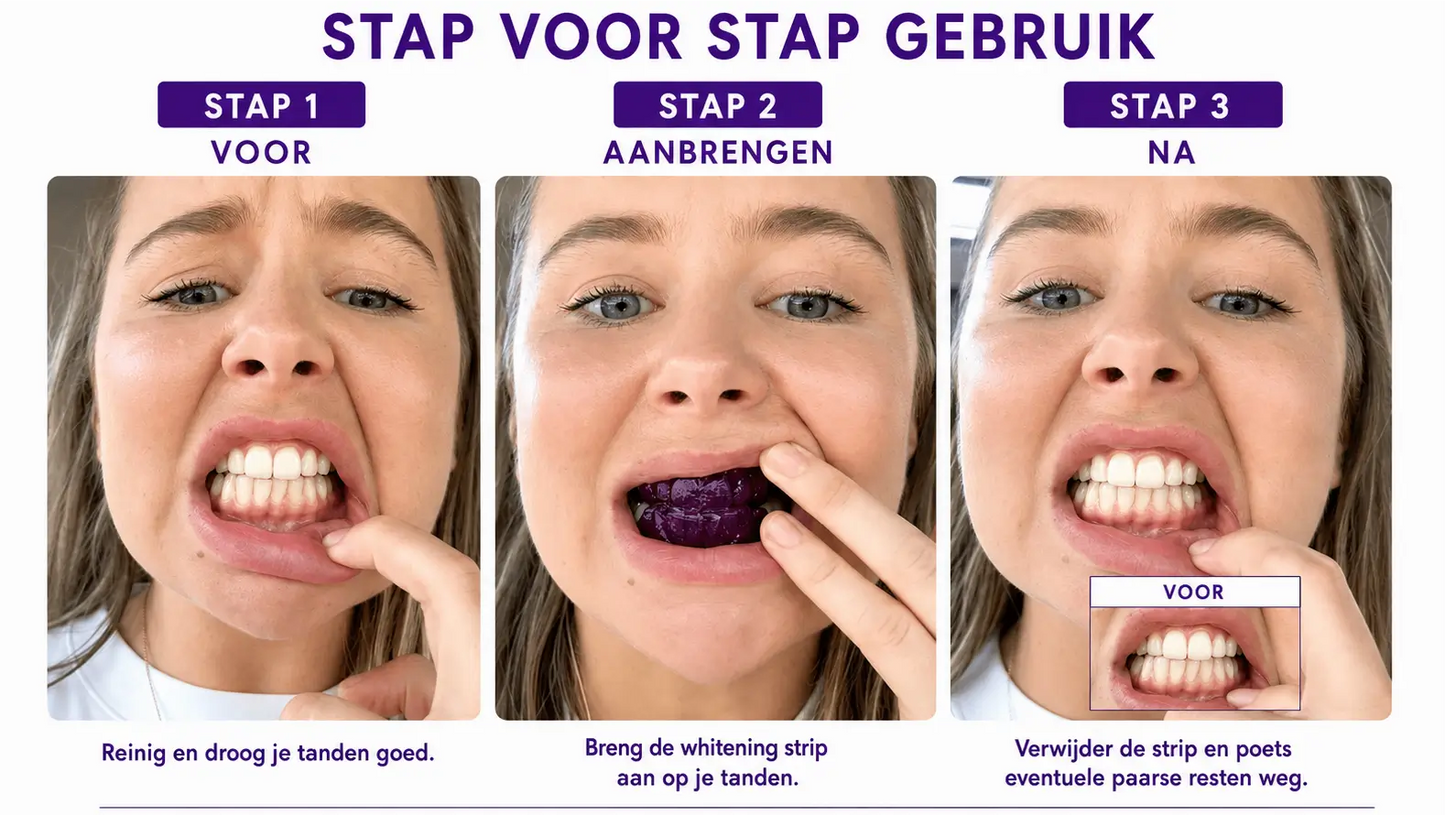 WITTSMILE™ — Direct wittere tanden | Koop 1, krijg 1 gratis